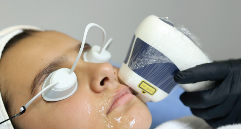 Depilación Laser  Diodo