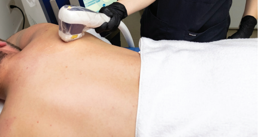 Depilación Laser  Diodo