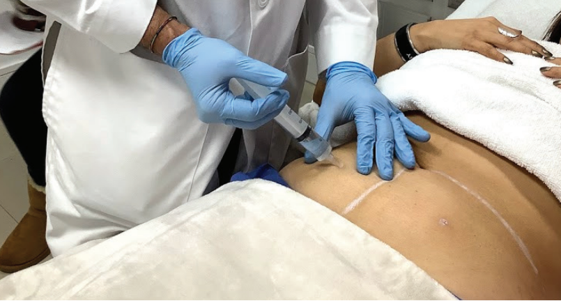 Enzimas Corporales y Faciales