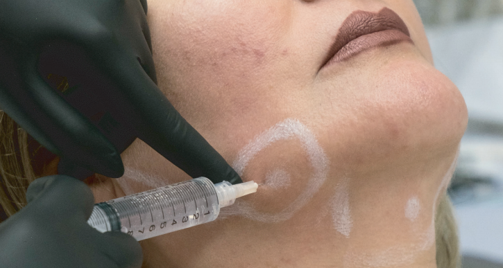 Enzimas Corporales y Faciales